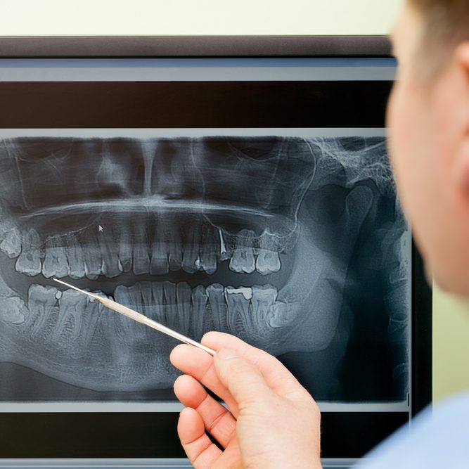 Dentist,Looking,Teeth,On,Digital,X-ray,Computer,Monitor